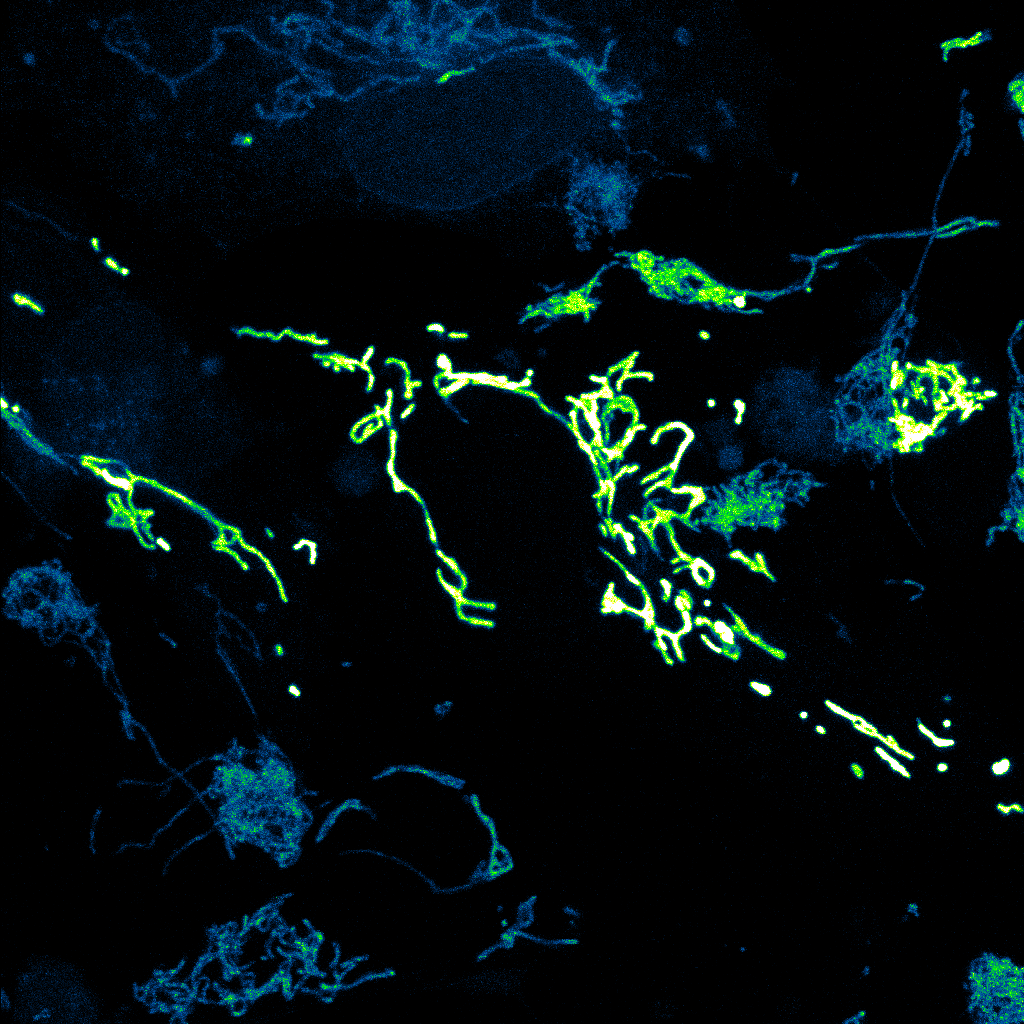 1C-01 mechanism diagram